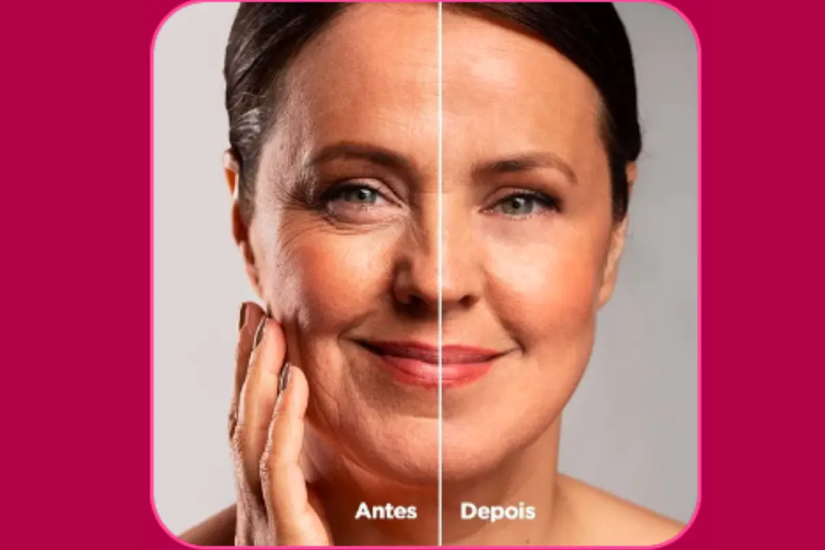 Rosa Mosqueta Amazônica